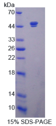 沉默调节蛋白7(SIRT7)重组蛋白