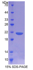 CD164分子(CD164)重组蛋白