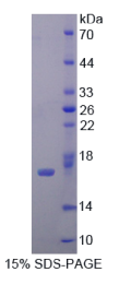 白介素12受体β2(IL2Rβ2)重组蛋白