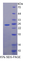 Zeste同源物增强子1(EZH1)重组蛋白