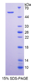 CD320分子(CD320)重组蛋白