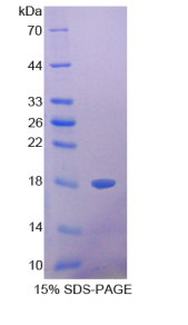 半乳糖凝集素1(GAL1)重组蛋白