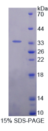 白介素20受体α(IL20Rα)重组蛋白