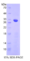 Numb同源物(NUMB)重组蛋白
