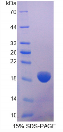 Ⅷ型胶原α2(COL8α2)重组蛋白