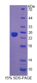 蛋白酪氨酸磷酸酶ⅣA3(PTPⅣA3)重组蛋白