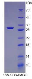 Ⅳ型胶原α2(COL4α2)重组蛋白