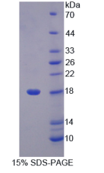 质载脂蛋白样蛋白1(LCNL1)重组蛋白