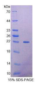 组蛋白脱乙酰基酶4(HDAC4)重组蛋白