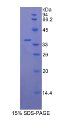 白介素22受体(IL22R)重组蛋白