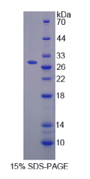 半胱氨酸丰富分泌蛋白3(CRISP3)重组蛋白