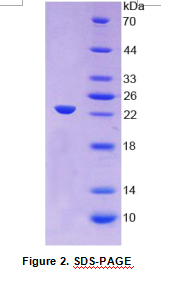 α1-酸性糖蛋白(α1AGP)重组蛋白