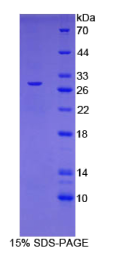 二氢嘧啶酶样蛋白3(DPYSL3)重组蛋白