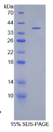 防御素β1(DEFβ1)重组蛋白