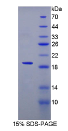 白介素12受体β2(IL2Rβ2)重组蛋白