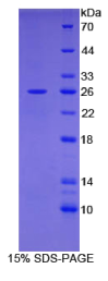 白介素2受体α(IL2Rα)重组蛋白