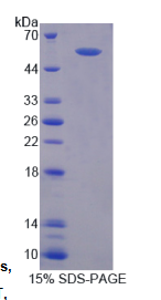 蛋白信号调节因子6(RGS6)重组蛋白