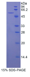 β-位淀粉样前体蛋白裂解酶1(βACE1)重组蛋白