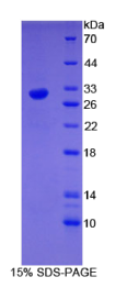早期生长应答因子4(EGR4)重组蛋白