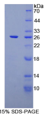 CD72分子(CD72)重组蛋白