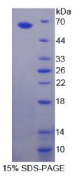 γ-氨基丁酸A受体α2(γABRα2)重组蛋白