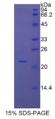 白介素1β(IL1β)重组蛋白