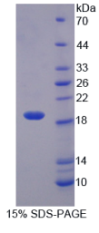 白介素1θ(IL1θ)重组蛋白