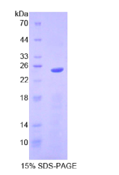 侧支发芽因子同源物2(SPRY2)重组蛋白