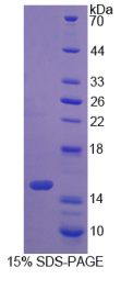 S100钙结合蛋白A16(S100A16)重组蛋白