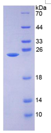 α1-微球蛋白(α1M)重组蛋白