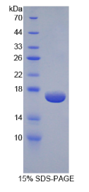 表皮生长因子途径底物蛋白1(EPN1)重组蛋白