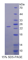 GluAsp丰富羧基端域Cbpp300相互作用反式激活因子1(CITED1)重组蛋白