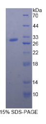 α2-巨球蛋白样蛋白1(α2ML1)重组蛋白