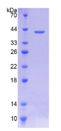 胆碱转运蛋白样蛋白1(CTL1)重组蛋白