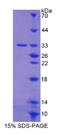 蛋白激酶D3(PKD3)重组蛋白