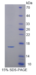 半胱氨酸蛋白酶抑制剂3(CST3)重组蛋白