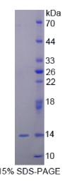 泛醌蛋白2(UBQLN2)重组蛋白