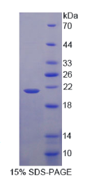 成神经细胞瘤抑制瘤变蛋白1(NBL1)重组蛋白