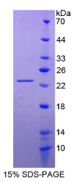 成纤维细胞生长因子10(FGF10)重组蛋白