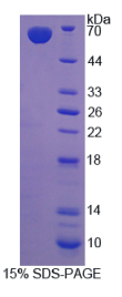 层粘连蛋白β2(LAMβ2)重组蛋白