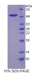 补体成分8γ(C8γ)重组蛋白