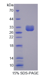 非红细胞血影蛋白β4(SPTβN4)重组蛋白