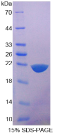 白介素1δ(FIL1δ)重组蛋白