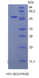 表皮生长因子受体2(EGFR2)重组蛋白