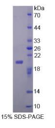 成纤维细胞生长因子22(FGF22)重组蛋白