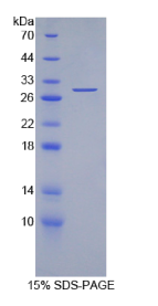 白介素2受体γ(IL2Rγ)重组蛋白