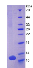 防御素β103A(DEFβ103A)重组蛋白