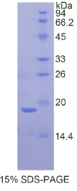 半乳糖凝集素7(GAL7)重组蛋白