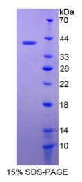 防御素β119(DEFβ119)重组蛋白