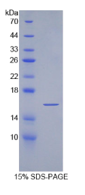 α-胞衬蛋白(SPTAN1)重组蛋白